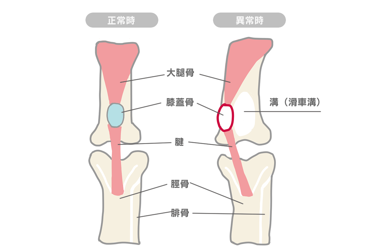 パテラ（犬の膝蓋骨脱臼）